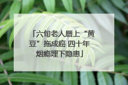 六旬老人唇上“黄豆”拖成癌 四十年烟瘾埋下隐患