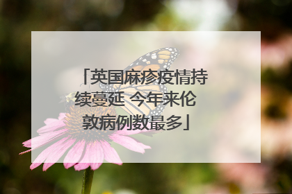 英国麻疹疫情持续蔓延 今年来伦敦病例数最多